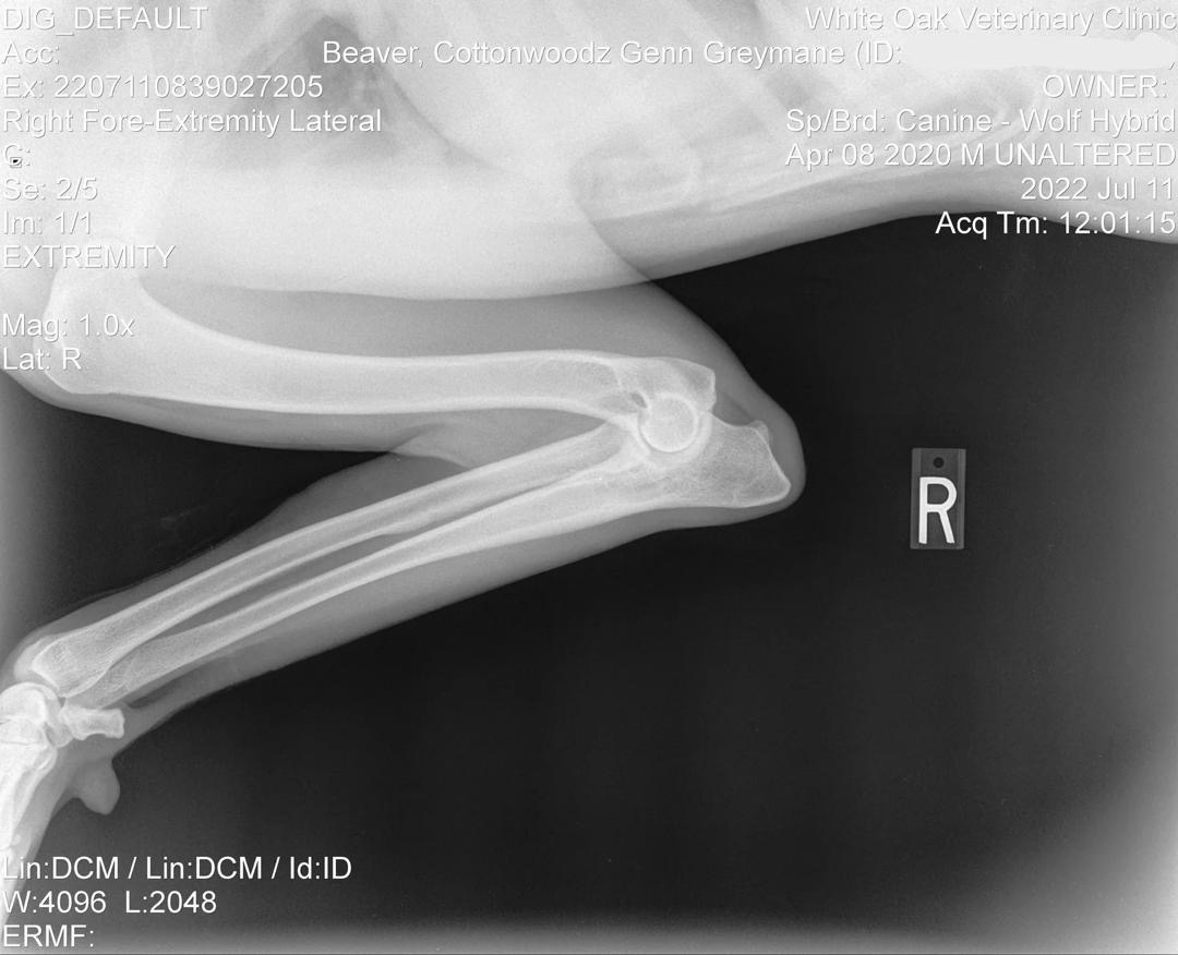 Genn Official Right Elbow X-Ray